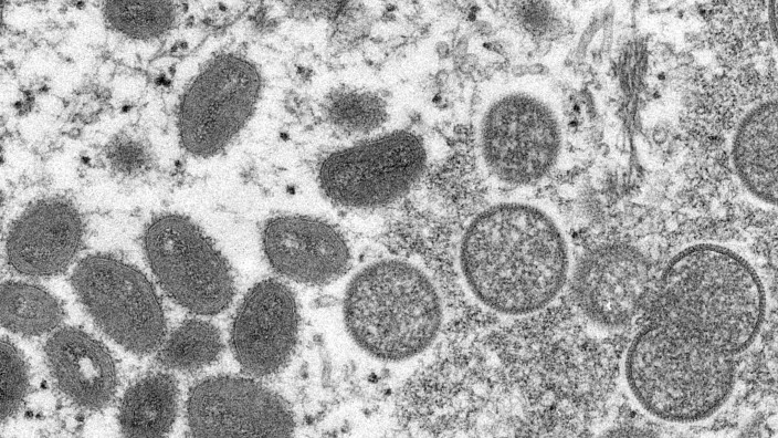 Gesundheit - Stuttgart: Eine elektronenmikroskopische Aufnahme zeigt reife, ovale Affenpockenviren (l). Foto: Cynthia S. Goldsmith/Russell Regner/CDC/AP/dpa/Symbolbild