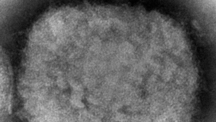 Gesundheit - Düsseldorf: Eine elektronenmikroskopische Aufnahme zeigt ein Affenpockenvirus. Foto: Cynthia S. Goldsmith/CDC via AP/dpa/Symbolbild