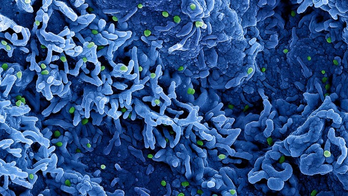 Krankheiten - Pforzheim: Eine mikroskopische Aufnahme des Affenpockenvirus (grün) auf der Oberfläche von infizierten VERO E6-Zellen (blau). Foto: Niaid/Planet Pix via ZUMA Press Wire/dpa