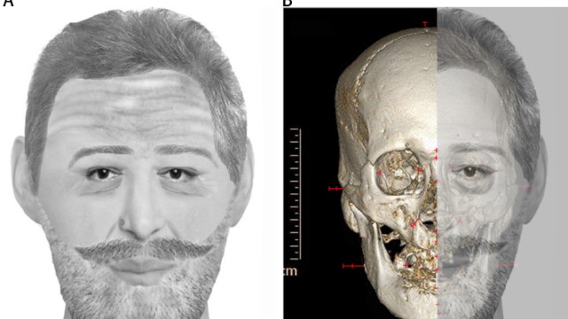 Forensik: Die Rekonstruktion des Gesichts auf der Basis eines 400 Jahre alten Schädels bestätigt: Der Kopf gehört mit großer Sicherheit zum Leichnam des französischen Königs Henri IV.