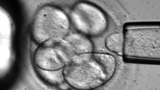 Menschenwürde und Bioethik: Einem menschlichen Embryo wird eine einzelne Zelle entnommen. Das Erbgut dieser Zelle wird bei der PID überprüft.