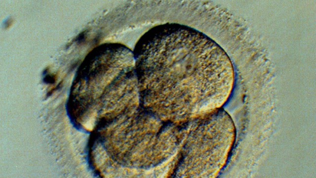 Präimplantationsdiagnostik: Manche Menschen sprechen bereits der befruchteten Eizelle Menschenwürde zu. Andere halten das für falsch.