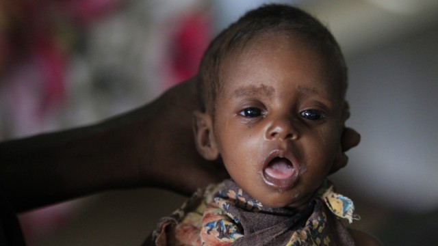 Ostafrika: Appell der UN: Der zwei Monate alte Fulhado Daud Aliyow aus Kenia. Viele Menschen dort sind bereits zu schwach, um sich vor der Dürre und der Hungersnot zu retten.