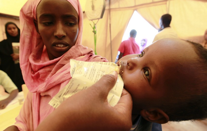 An internally displaced malnourished child receives food supplements at a mobile medical facility at the Hiran IDP settlement in Galkayo