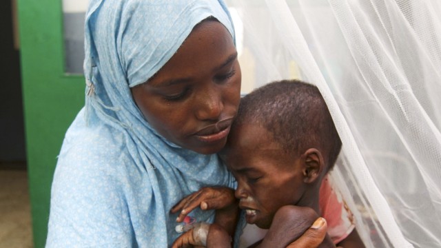 Somali woman holds her malnourished child at the Banadir hospital in southern Mogadishu