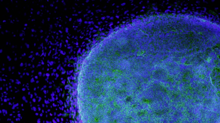 A microscopic view shows a colony of human embryonic stem cells growing on fibroblasts in this handout photo