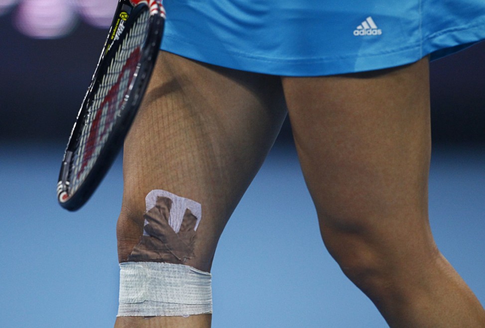 Bandaged right knee of Petkovic is seen after she picked up an injury during her women's final match against Radwanska at the China Open tennis tournament