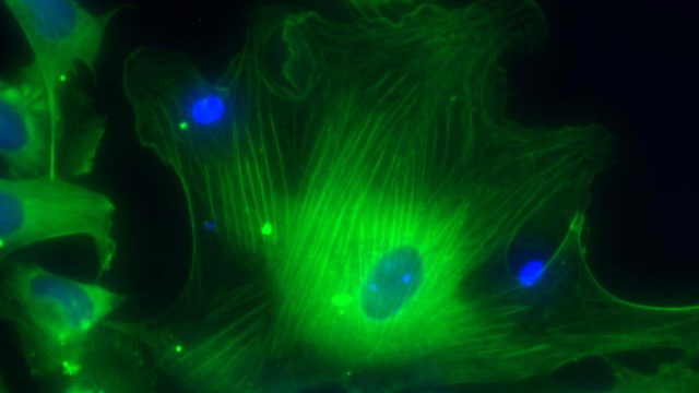 A microscopic view shows smooth muscle cells derived from human embryonic stem cells