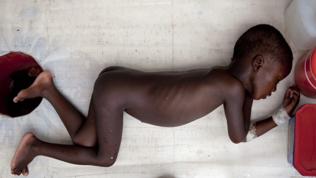 Haiti: Mirebalais, Haiti: Wilson, 4, leidet unter der Cholera (Archiv von Juli  2011)