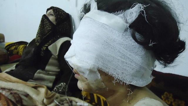 Wounded girl is seen in Baba Amro, a neighbourhood of Homs