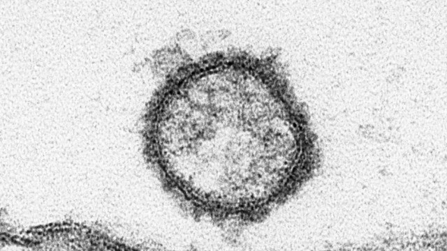 Schmallenberg-Virus