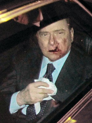 Berlusconi, Attacke, dpa