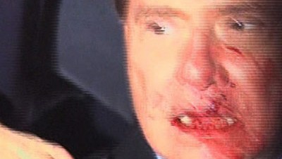 Attacke auf Italiens Premier: Nasenbeinbruch, Zähne angeschlagen, Lippe verletzt: Der blutende Berlusconi unmittelbar nach dem Angriff in Mailand.