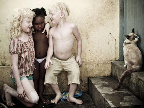 Albinos, Reuters
