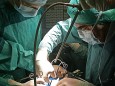 Organtransplantation während einer Operation