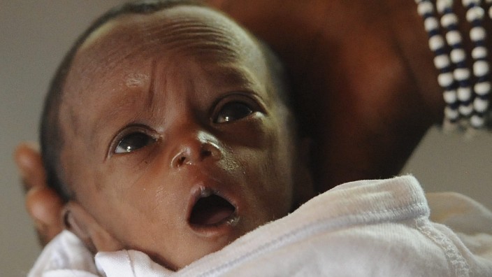 Unterernährtes Kind in einem Hospital in Kaya, Burkina Faso. Die Zahl der Todesfälle von Kindern unter fünf Jahren ist in den vergangenen 20 Jahren weltweit von mehr als zwölf auf 6,9 Millionen gesunk