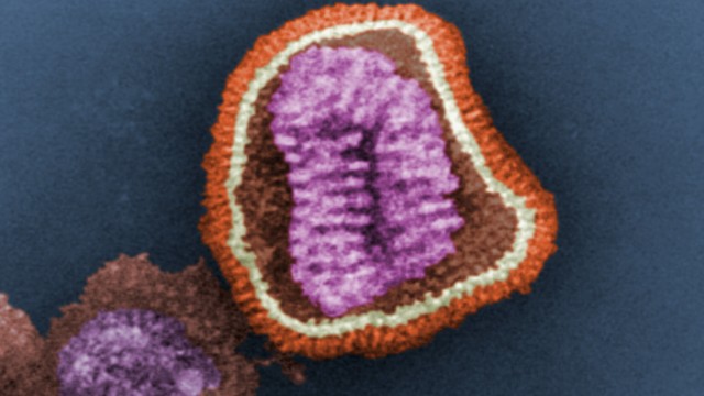 Ein Grippe-Virus besteht aus organischen Molekülen und kann sich in Zellen eines Wirts vermehren. Doch lebt es?