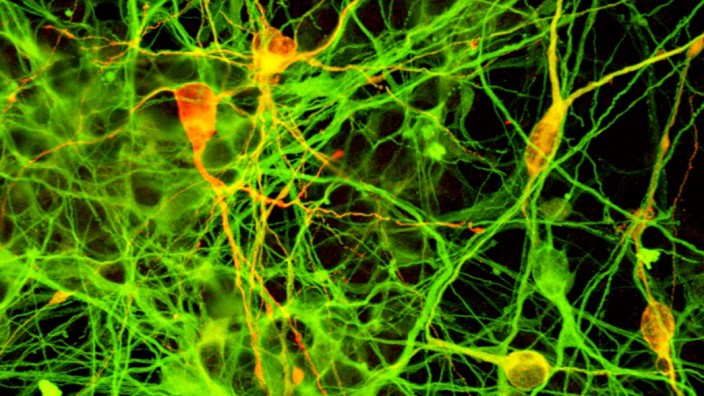 Nervenzellen aus iPS-Zellen