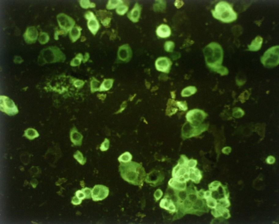 Mit SARS infizierte Zellen, 2003