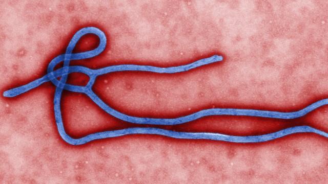 Von Ebola-Viren geht für Menschen eine tödliche Gefahr aus.