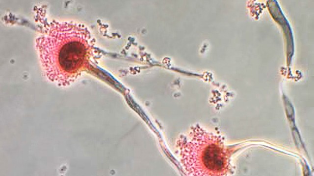 Aspergillus fumigatus: Pilzinfektionen werden unterschätzt