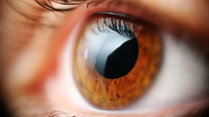 Augenfarben seltensten Blaue Kontaktlinsen