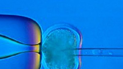 Künstliche Befruchtung gegen Eizellen: Für Klon-Experimente benötigen britische Mediziner zahlreiche Eizellen - doch die Spendenbereitschaft von Frauen war bisher eher gering.