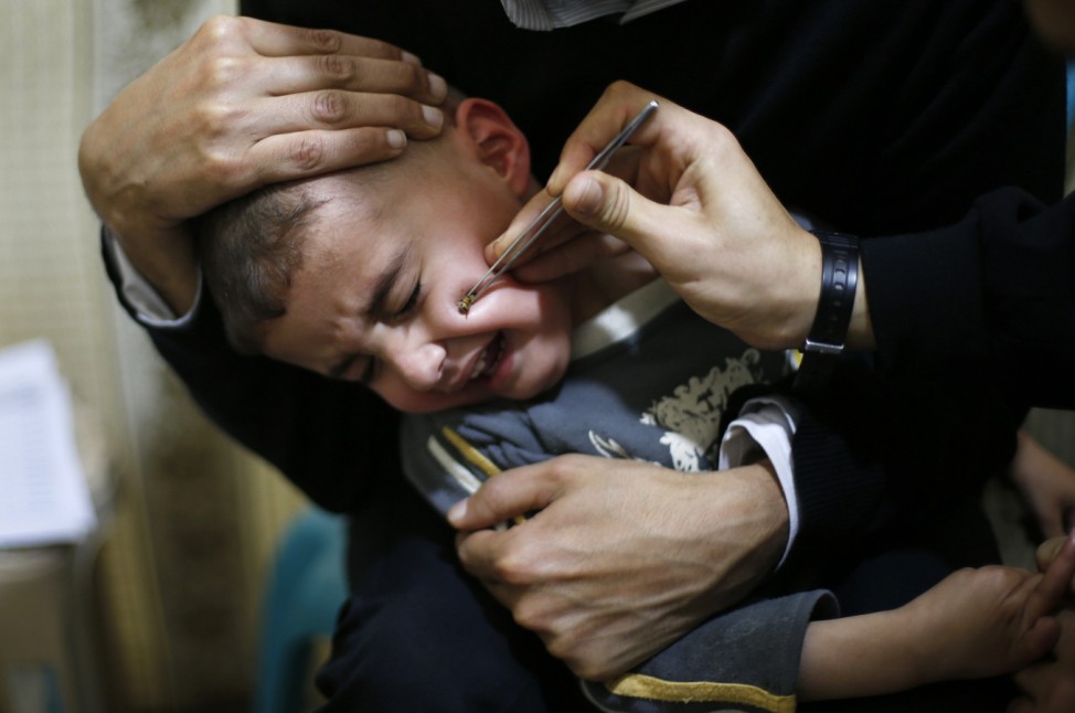 A Palestinian boy suffering from Paranasal sinus cries as he receives treatment at a bee venom therapy center in Gaza City