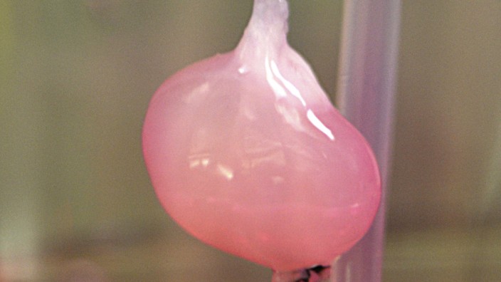 A functional lab-made kidney is pictured in this handout photo