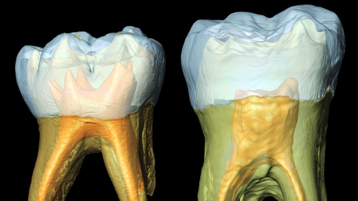 Die Zähne des Neandertalers geben Auskunft über seine Kindheit