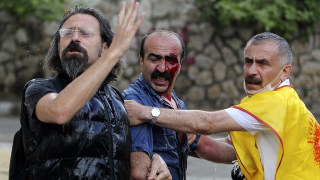 Anti-government protesters ask for help for their wounded fellow after riot police attack them during a protest in Ankara