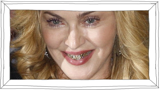 Promiblog zu Madonna und ihrem Zahnschmuck: Schön-schauriger Schmuck für die Zähne: Madonna bei am Mittwoch in Rom.