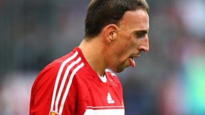 FC Bayern München: Die Bayern erklären die Diskussionen um Franck Ribéry für beendet.