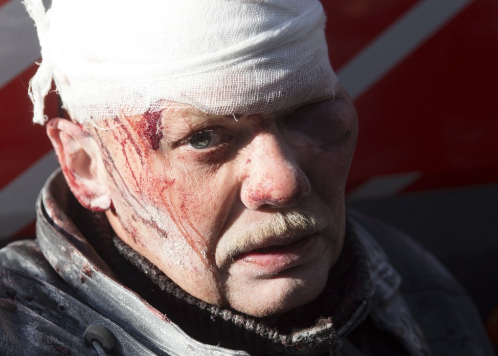 A man looks on after being injured in clashes between anti-government protesters with Interior Ministry members in Kiev