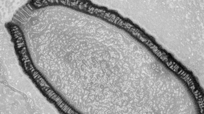 Ein Pithovirus in einer infizierten Zelle