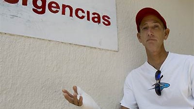 Nach tödlichen Angriffen: Bruce Grimes: Der amerikanische Surfer hatte Glück - er überlebte eine Hai-Attacke in Mexiko und wurde - nur - am Arm verletzt.