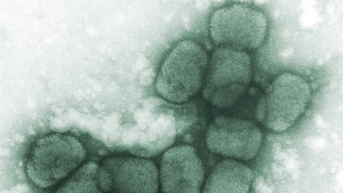 Die letzten Pockenviren: Pockenviren unter dem Elektronenmikroskop. Soweit Forscher wissen, gibt es sie nirgendwo mehr in freier Natur.