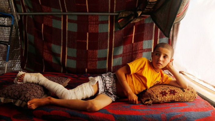 A Syrian refugee boy, who was injured in a recent bombing beside Bab Al-Salam refugee camp, poses as he rests in his tent in Azaz, near the Syrian-Turkish border
