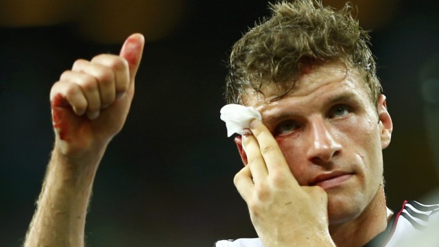 Germany's Thomas Mueller gives a thumbs up while holding his bleeding head after the 2014 World Cup Group G soccer match between Germany and Ghana at the Castelao arena