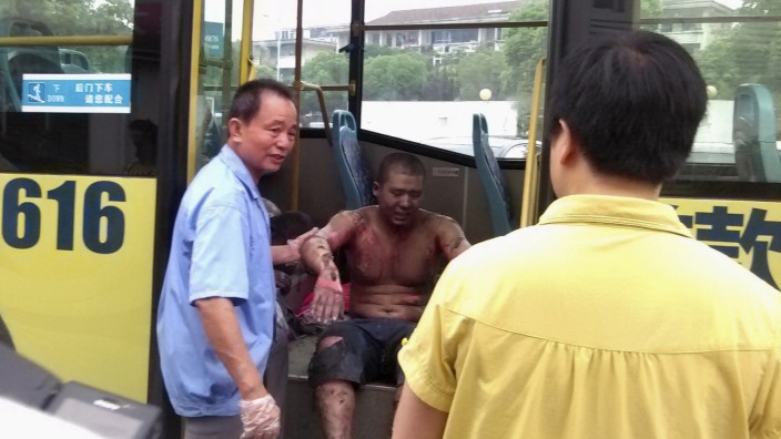 Rescuers help an injured man get off a bus, near a hospital, after an explosion at a factory in Kunshan