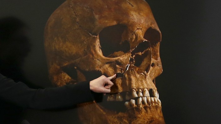 File photo of project osteologist Appleby pointing out the damage to a skull believed to be that of Richard III during a news conference in Leicester