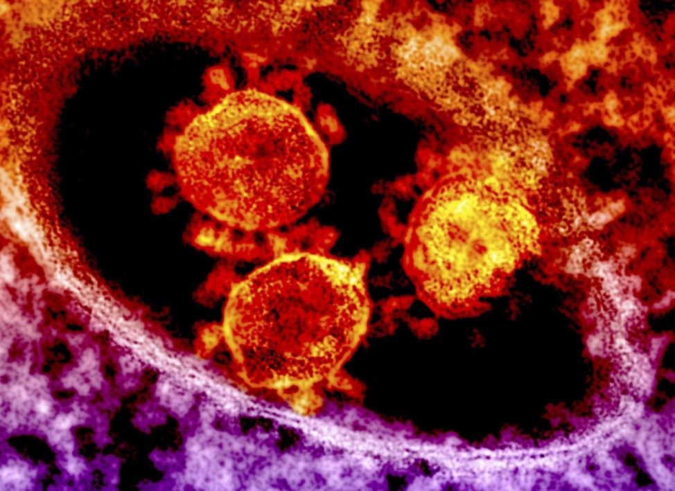 Handout transmission electron micrograph shows particles of the Middle East respiratory syndrome coronavirus