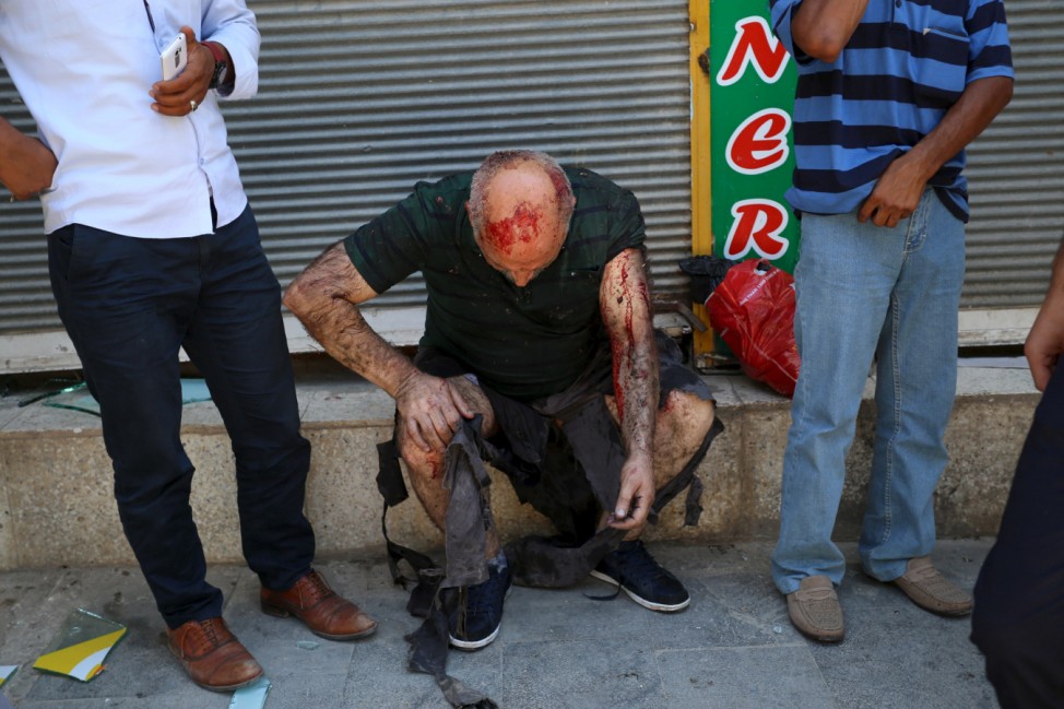 A wounded man pauses following an explosion in Suruc in southeastern Sanliurfa province, Turkey