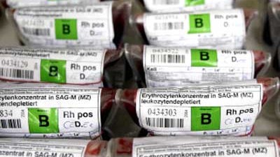 Transfusionen: Ärzte wollen das beste Blut für Transfusionen finden.