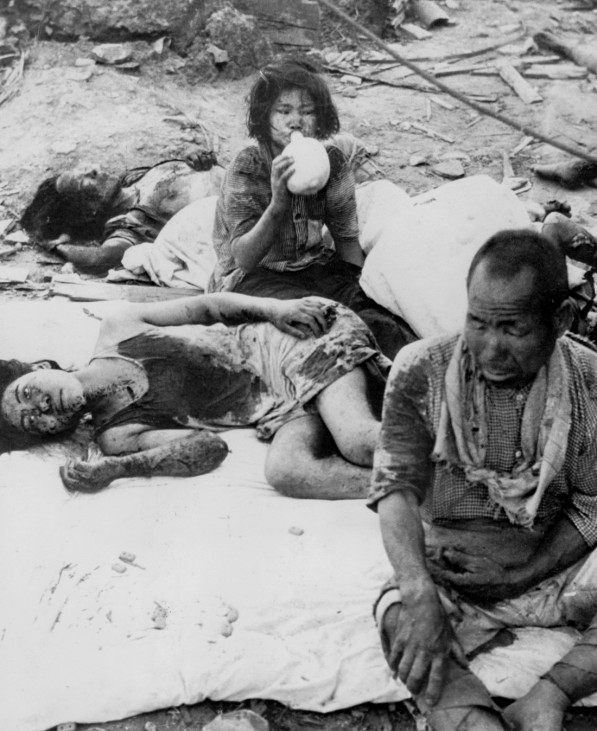 Verletzte nach dem Atombombenabwurf auf Hiroshima, 1945