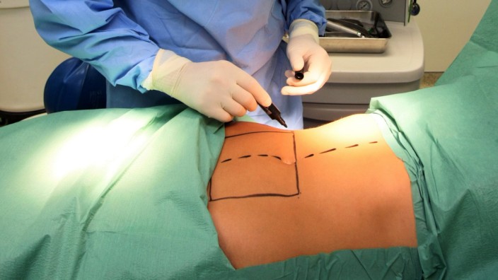 Studie: Ein Schönheitschirurg bereitet einen Eingriff am Bauch einer Patientin vor.
