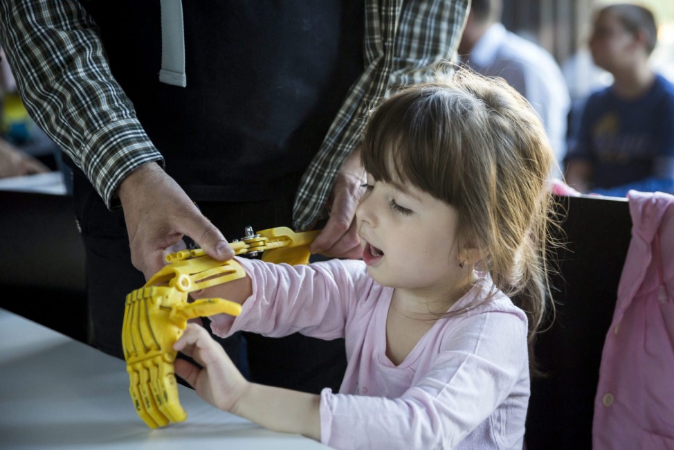 3D-printed prosthetic hand presented in Budapest
