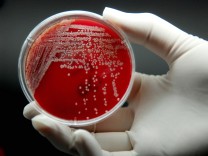 Infektionskrankheiten: Wie lange Antibiotika eingenommen werden sollten