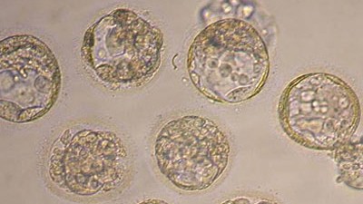 Debatte über Stammzellengesetz: Die Mikroskop-Aufnahme der Universität in Seoul zeigt geklonte Embryonen im achtzelligen Stadion.