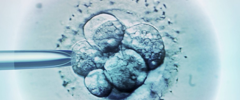 Embryo selection for IVF light micrograph Embryo selection for IVF light micrograph PUBLICATIONxIN